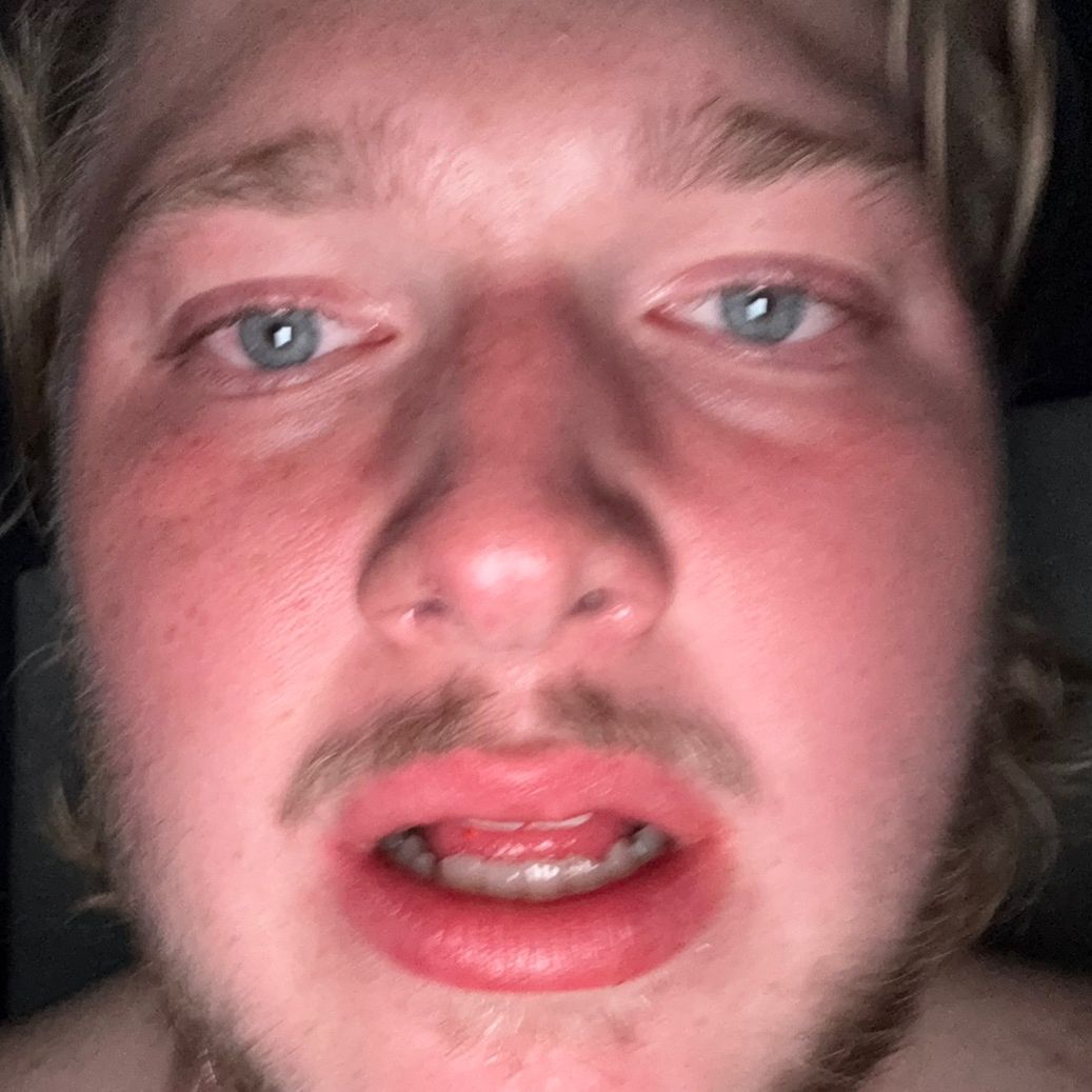 Cope