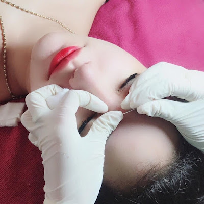 Acne Treatment Mai Ngoc Channel Official