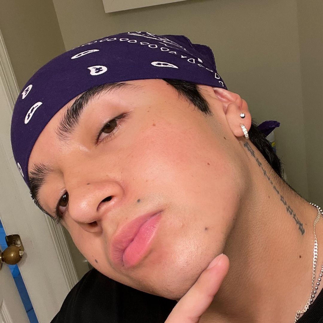 Anthony