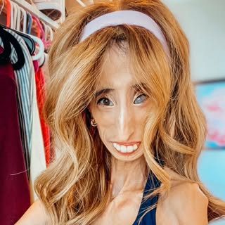 Lizzie Velasquez