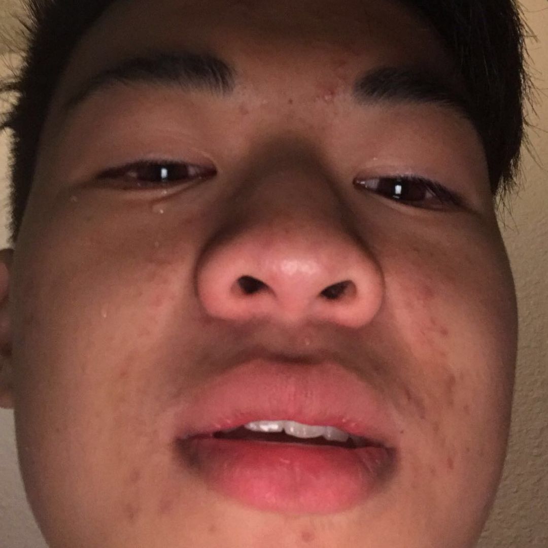 ben