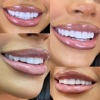 Dental Cosmetic Turkey