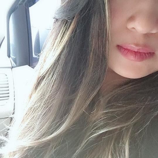 Dyna
