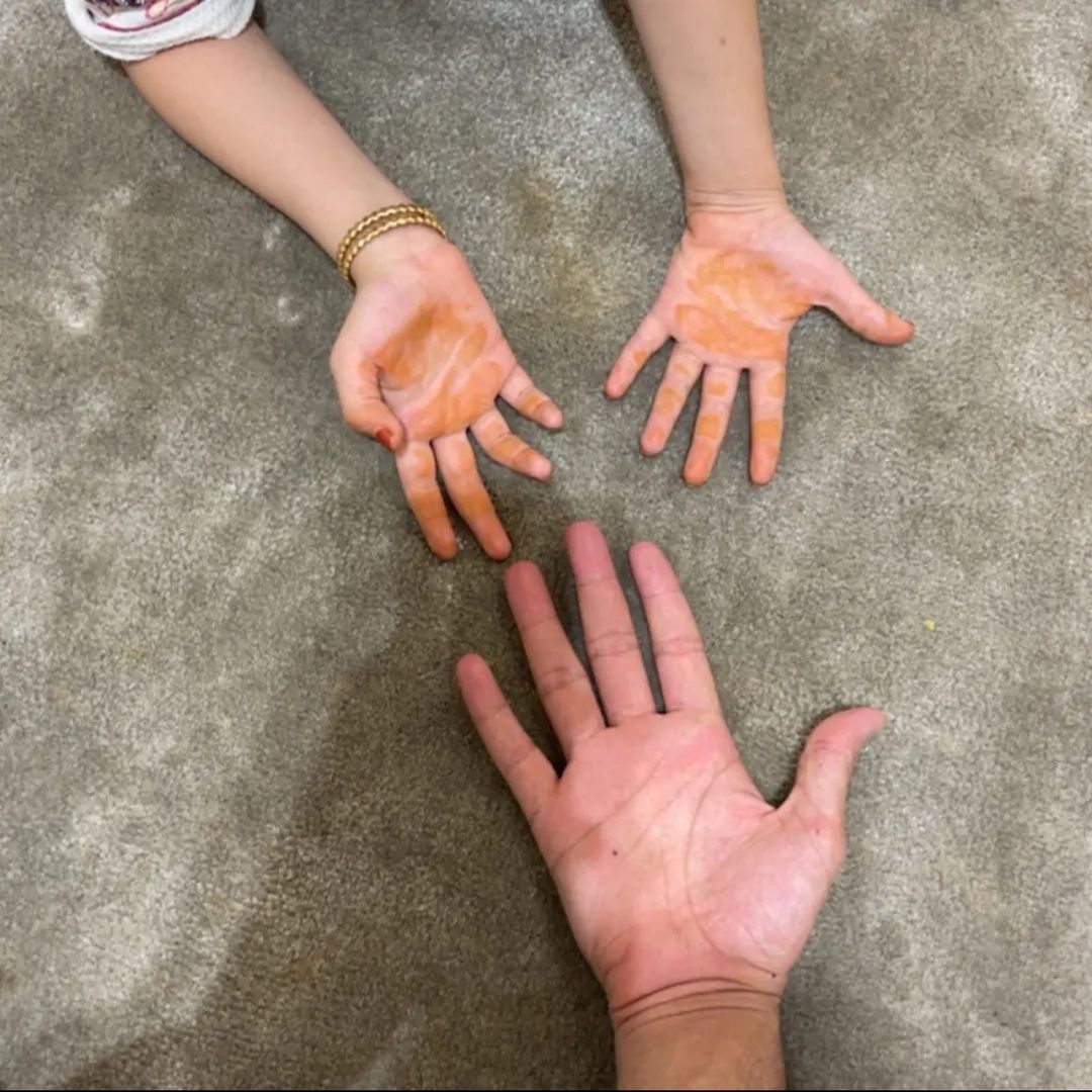 𝐸𝑖 𝐴𝑙𝑎𝑤𝑖𝑚𝑎𝑟𝑖.