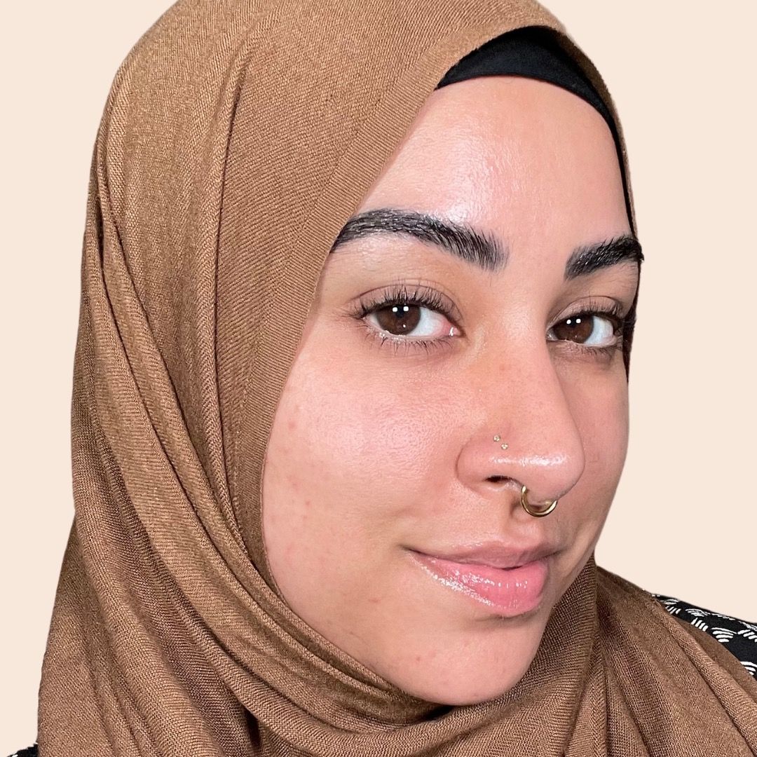 Anika-Licensed Skin Therapist