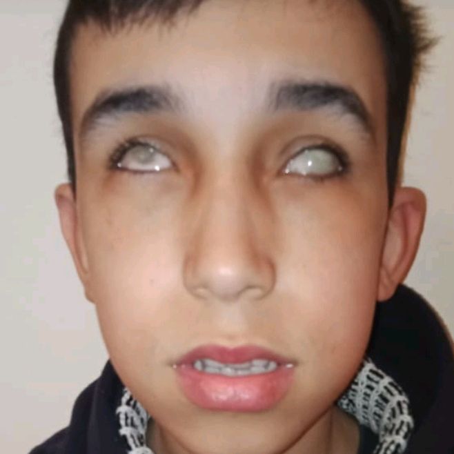 اخوكم المكفوف