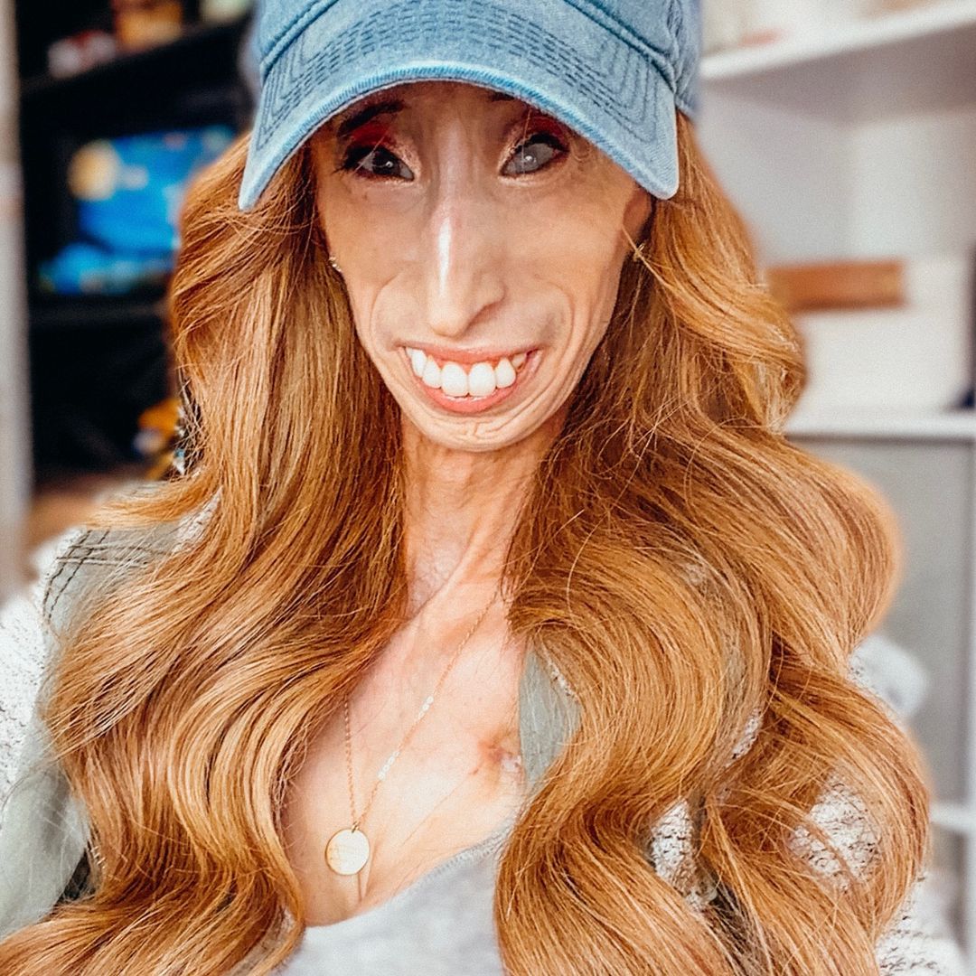 Lizzie Velasquez
