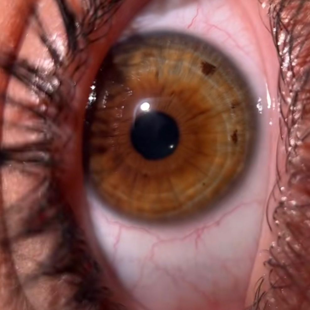 Ochii după TikTok👁️👁️👀👀👁️