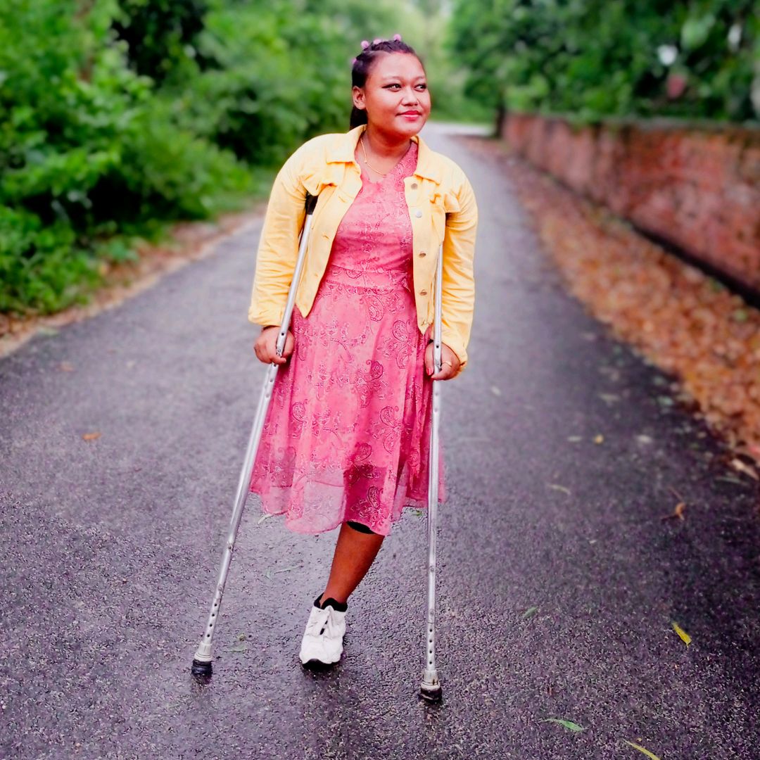 one leg dancer Shristi 🙏