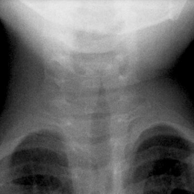 Radiology Signs