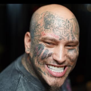 Stitches