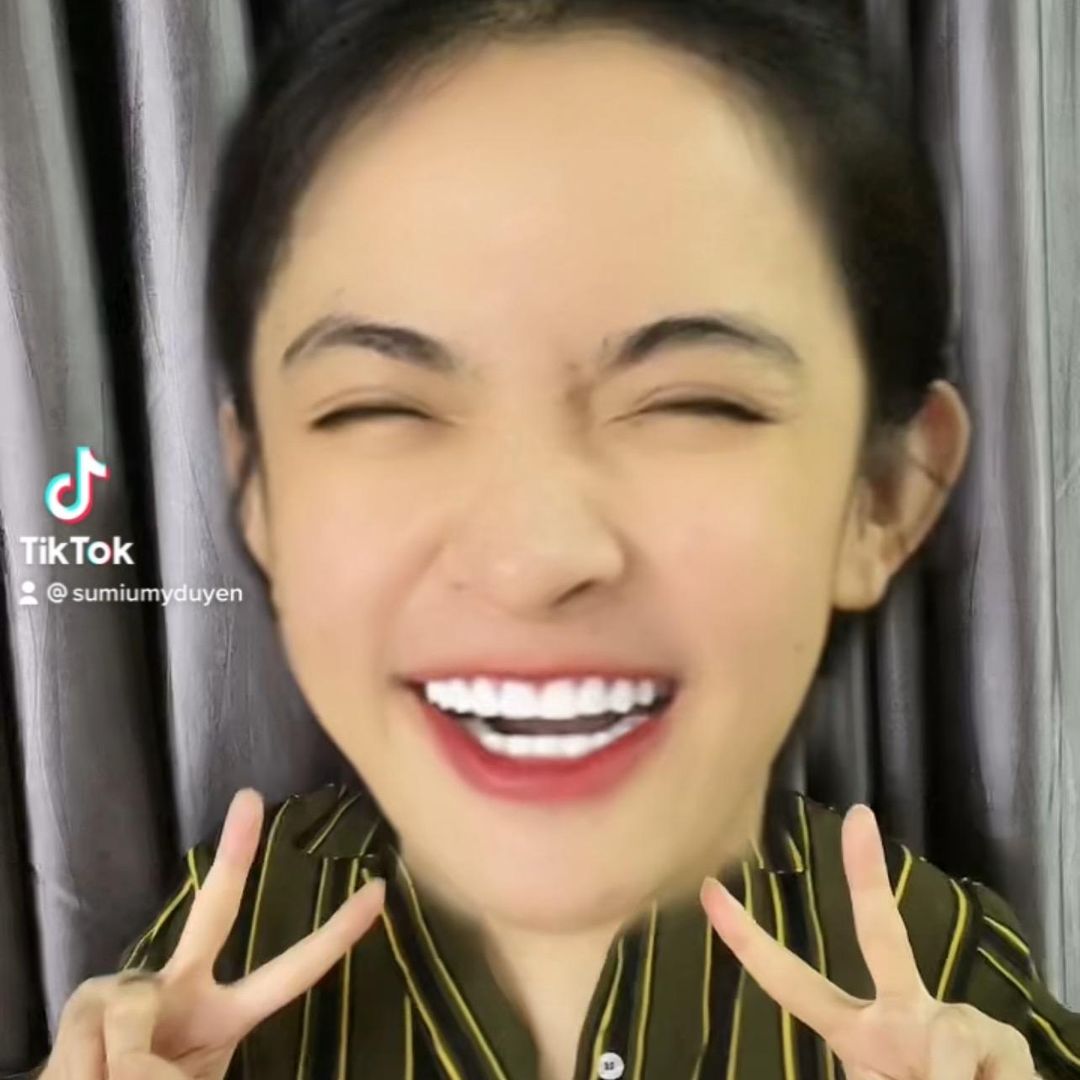 Su Đầu To