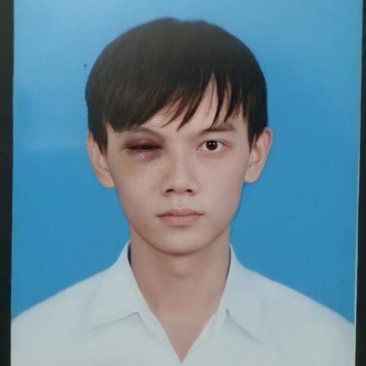Tiểu Mỹ