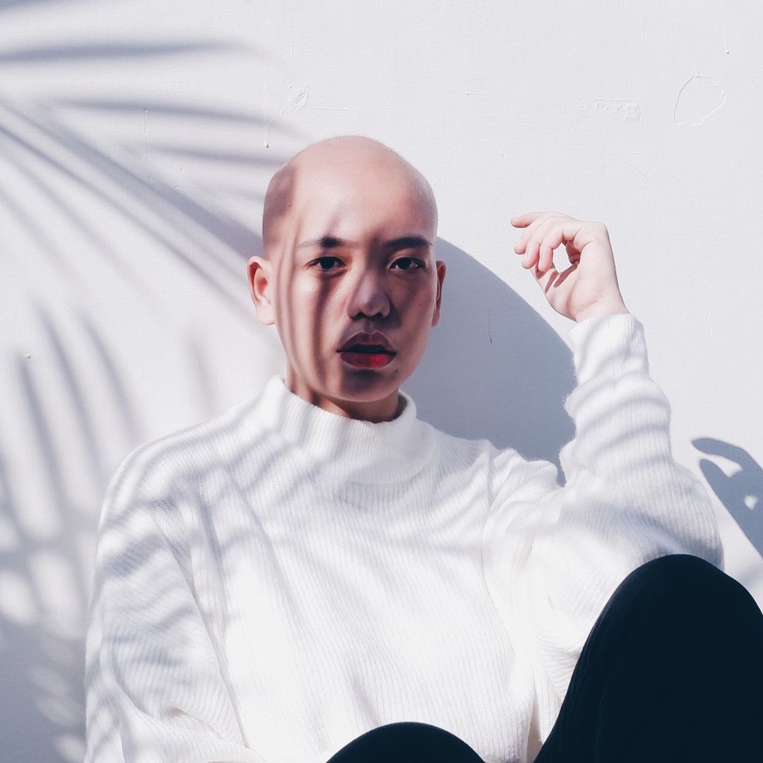Yun | Alopecia Awareness🧑‍🦲