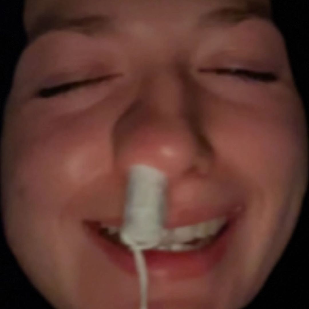 Zoeprickett